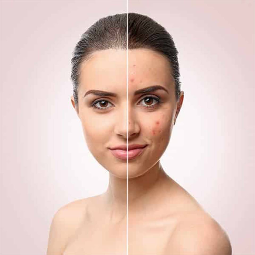 Woman receiving a professional facial and skin treatment at a cosmetology clinic and med spa near me