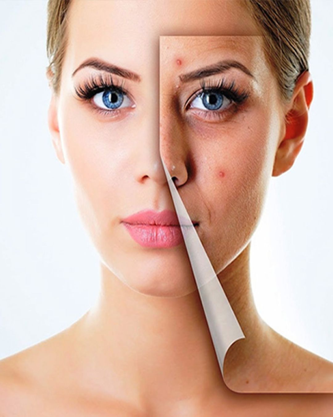 Acne treatment and facial services at a top skin treatment clinic near me, offering personalized care for clear, healthy skin.